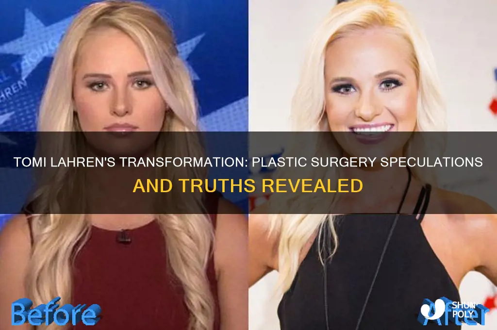 did tomi laurhen get plastic surgery