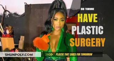 Did Tommie Undergo Plastic Surgery? Uncovering the Truth and Speculations