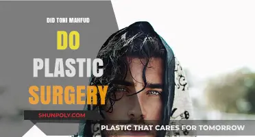 Toni Mahfud's Transformation: Plastic Surgery Speculations and Truths