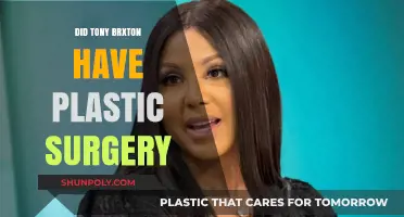Did Toni Braxton Undergo Plastic Surgery? Unveiling the Truth