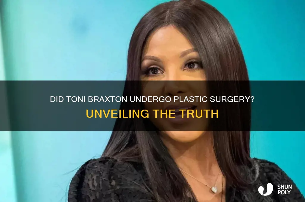did tony brxton have plastic surgery
