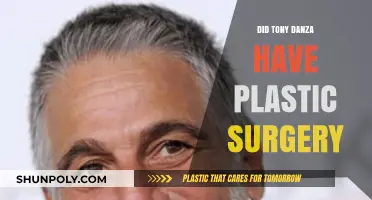 Tony Danza's Transformation: Plastic Surgery Rumors Explored and Debunked