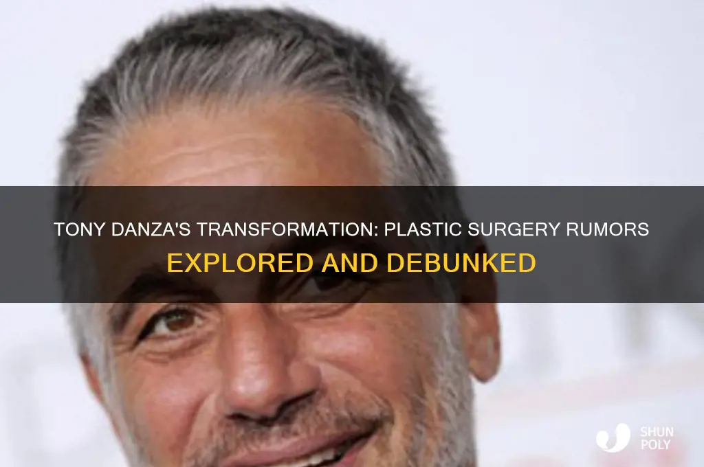 did tony danza have plastic surgery