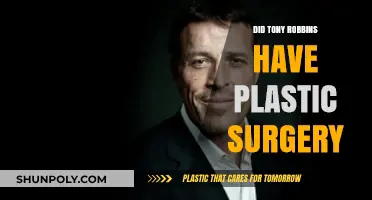 Tony Robbins Plastic Surgery: Fact or Fiction? Unveiling the Truth
