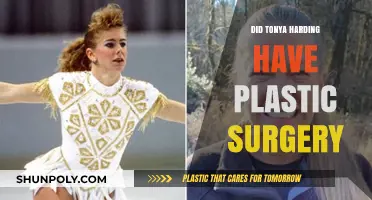Tonya Harding's Transformation: Plastic Surgery Speculations and Truths Revealed