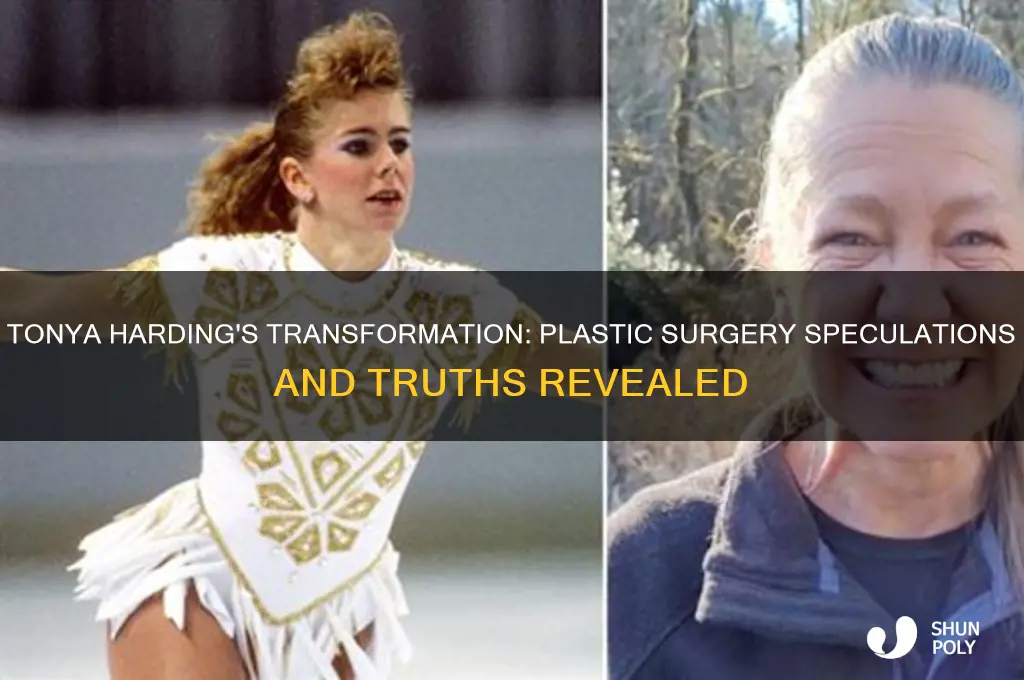 did tonya harding have plastic surgery
