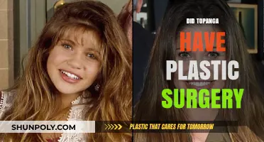 Topanga's Transformation: Unveiling the Truth About Plastic Surgery Rumors