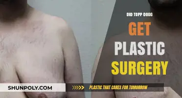Did Topp Dogg Undergo Plastic Surgery? Uncovering the Truth and Speculations