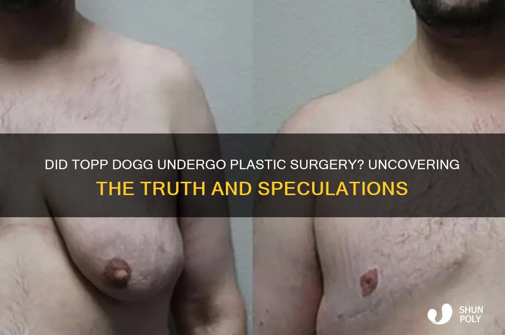 did topp dogg get plastic surgery