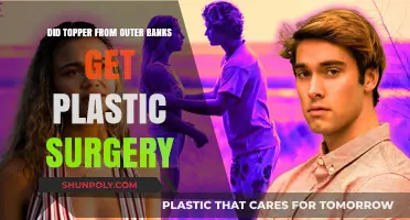 Did Outer Banks' Topper Undergo Plastic Surgery? The Truth Revealed