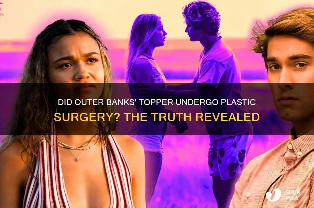 did topper from outer banks get plastic surgery