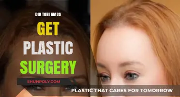 Tori Amos Plastic Surgery: Fact-Checking the Rumors and Speculations