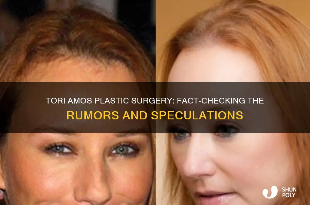 did tori amos get plastic surgery