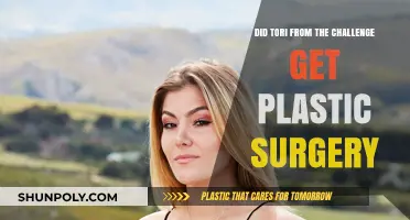 Did Tori From The Challenge Undergo Plastic Surgery? Unveiling the Truth