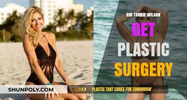 Torrie Wilson's Transformation: Plastic Surgery Rumors Explored and Debunked