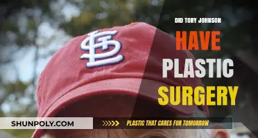 Tory Johnson Plastic Surgery: Fact-Checking the Rumors and Speculations