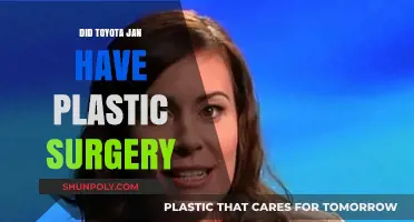 Toyota Jan Plastic Surgery Rumors: Fact or Fiction?