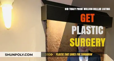 Tracy Million Dollar Listing Plastic Surgery: Fact or Fiction?