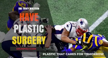 Tracy Wolfson's Transformation: Plastic Surgery Speculations and Facts Revealed