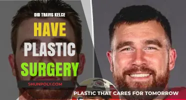 Travis Kelce's Transformation: Plastic Surgery Rumors Explored and Debunked