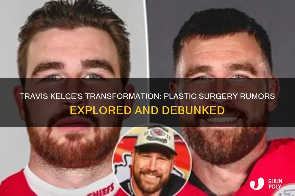did travis kelce have plastic surgery