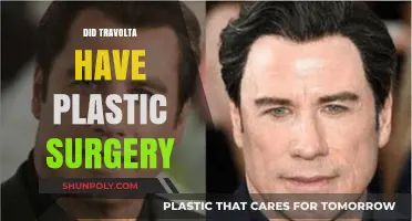 John Travolta's Transformation: Plastic Surgery Speculations and Truths Revealed