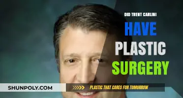 Did Trent Carlini Undergo Plastic Surgery? Unveiling the Truth