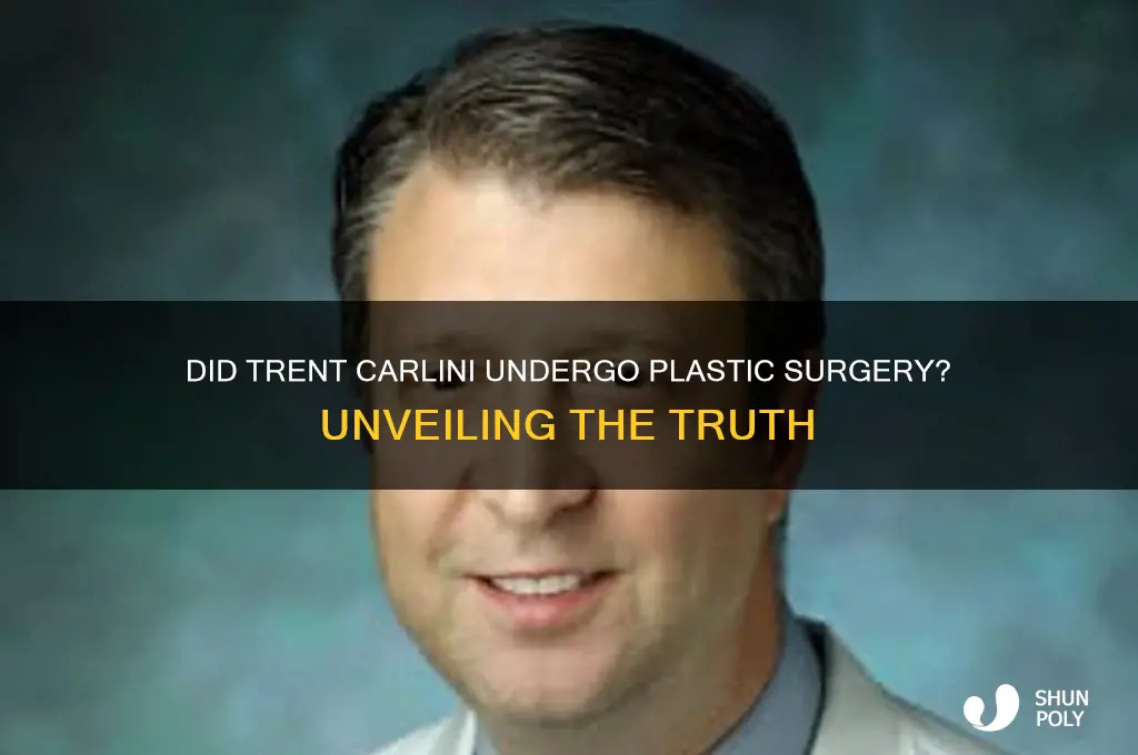 did trent carlini have plastic surgery
