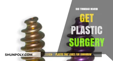 Trinidad Marin Plastic Surgery: Fact or Fiction? Unveiling the Truth