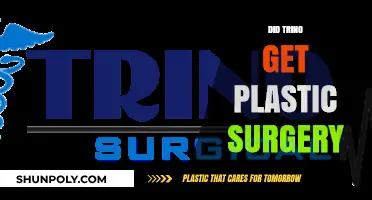 Did Trino Undergo Plastic Surgery? Uncovering the Truth Behind the Rumors