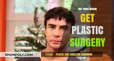 Trino Marin's Transformation: Plastic Surgery Rumors Explored and Debunked