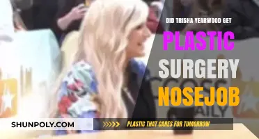Trisha Yearwood's Nose Transformation: Plastic Surgery Speculations Explored