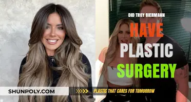Troy Biermann's Transformation: Plastic Surgery Speculations and Truths