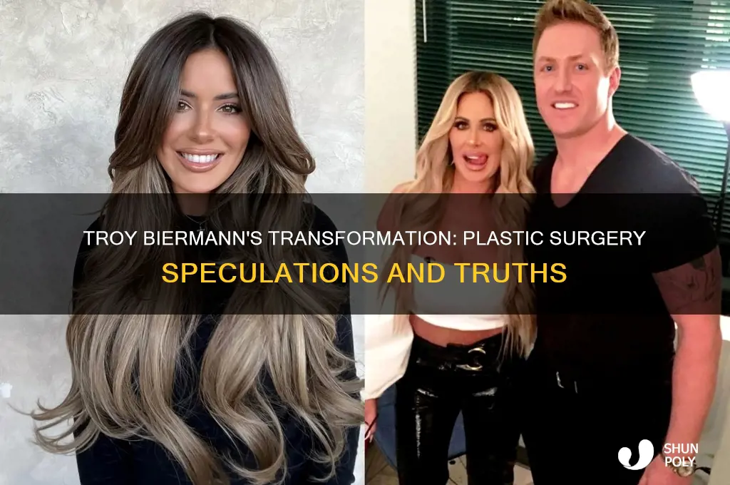 did troy biermann have plastic surgery