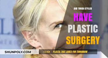 Trudi Styler's Transformation: Plastic Surgery Speculations and Truths