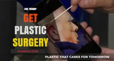 Unveiling the Truth: Did Donald Trump Undergo Plastic Surgery?
