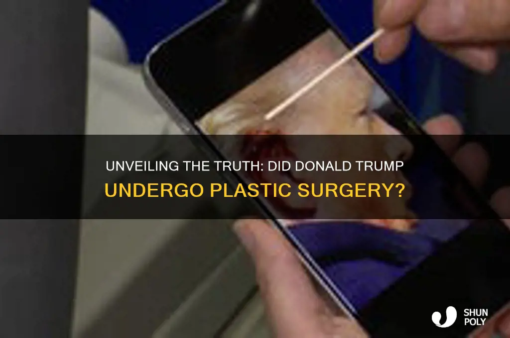 did trump get plastic surgery