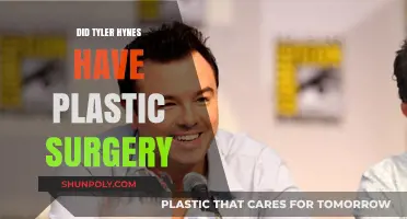 Tyler Hynes Plastic Surgery: Fact-Checking the Rumors and Speculations