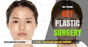 Did Tzuyang Undergo Plastic Surgery? Unraveling the Truth Behind Her Look