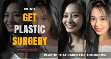 Tzuyu's Transformation: Plastic Surgery Rumors and the Truth Behind Them