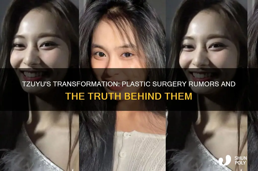 did tzuyu get plastic surgery
