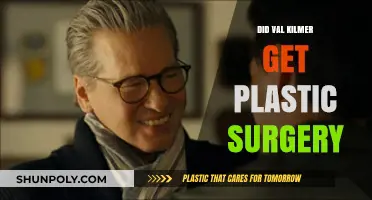 Val Kilmer's Transformation: Plastic Surgery Rumors Explored and Debunked