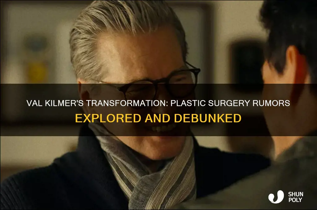 did val kilmer get plastic surgery