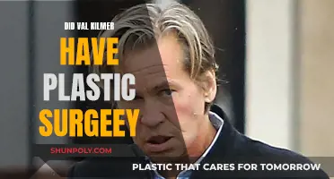 Val Kilmer's Plastic Surgery: Did He or Didn't He?