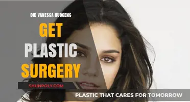 Vanessa Hudgens Plastic Surgery: Fact or Fiction? Unveiling the Truth