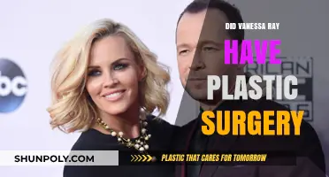 Vanessa Ray's Transformation: Plastic Surgery Speculations and Facts Revealed