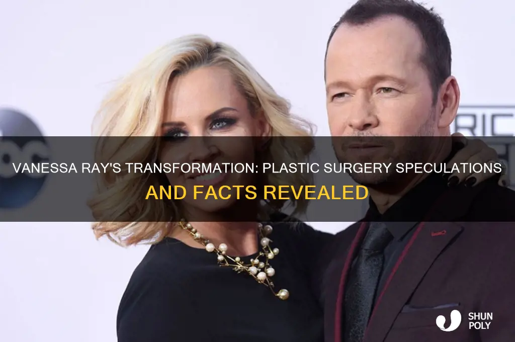 did vanessa ray have plastic surgery