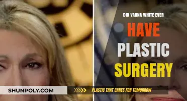 Vanna White's Beauty Secrets: Plastic Surgery Speculations Explored