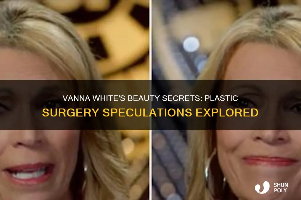 did vanna white ever have plastic surgery