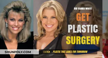Vanna White's Transformation: Plastic Surgery Rumors Explored and Debunked